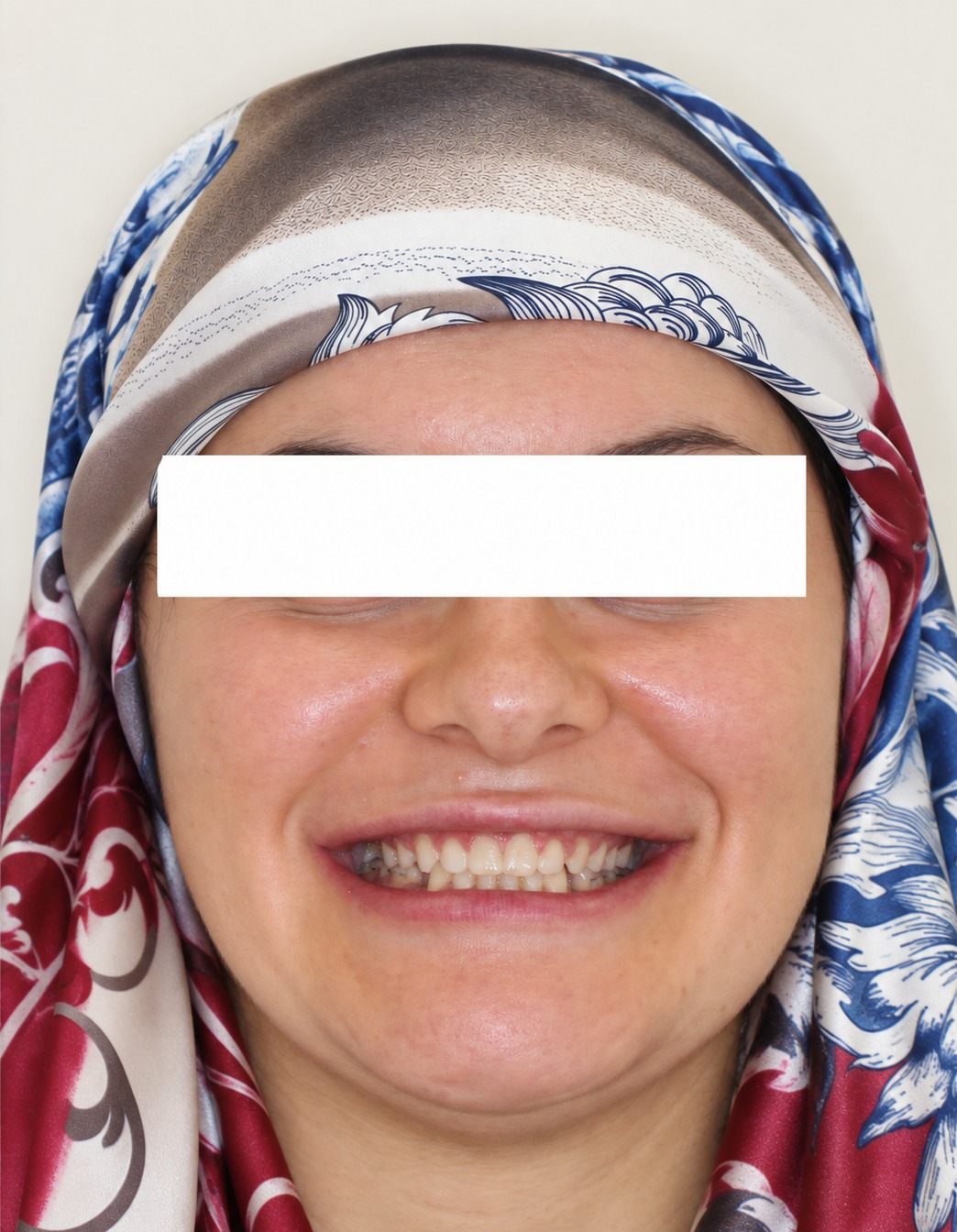 After treatment